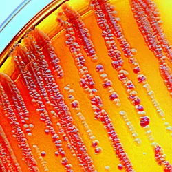 Bacteria grown on a selective agar plate.