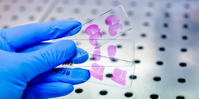 A gloved hand holds two glass microscope slides containing pink-stained tissue sections in a laboratory setting.