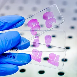 A gloved hand holds two glass microscope slides containing pink-stained tissue sections in a laboratory setting.
