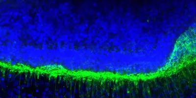 A microscopic picture of the human retina model in blue and green.