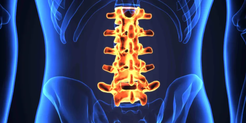 The lumbar spinal column shown in bright orange over a blue body background.