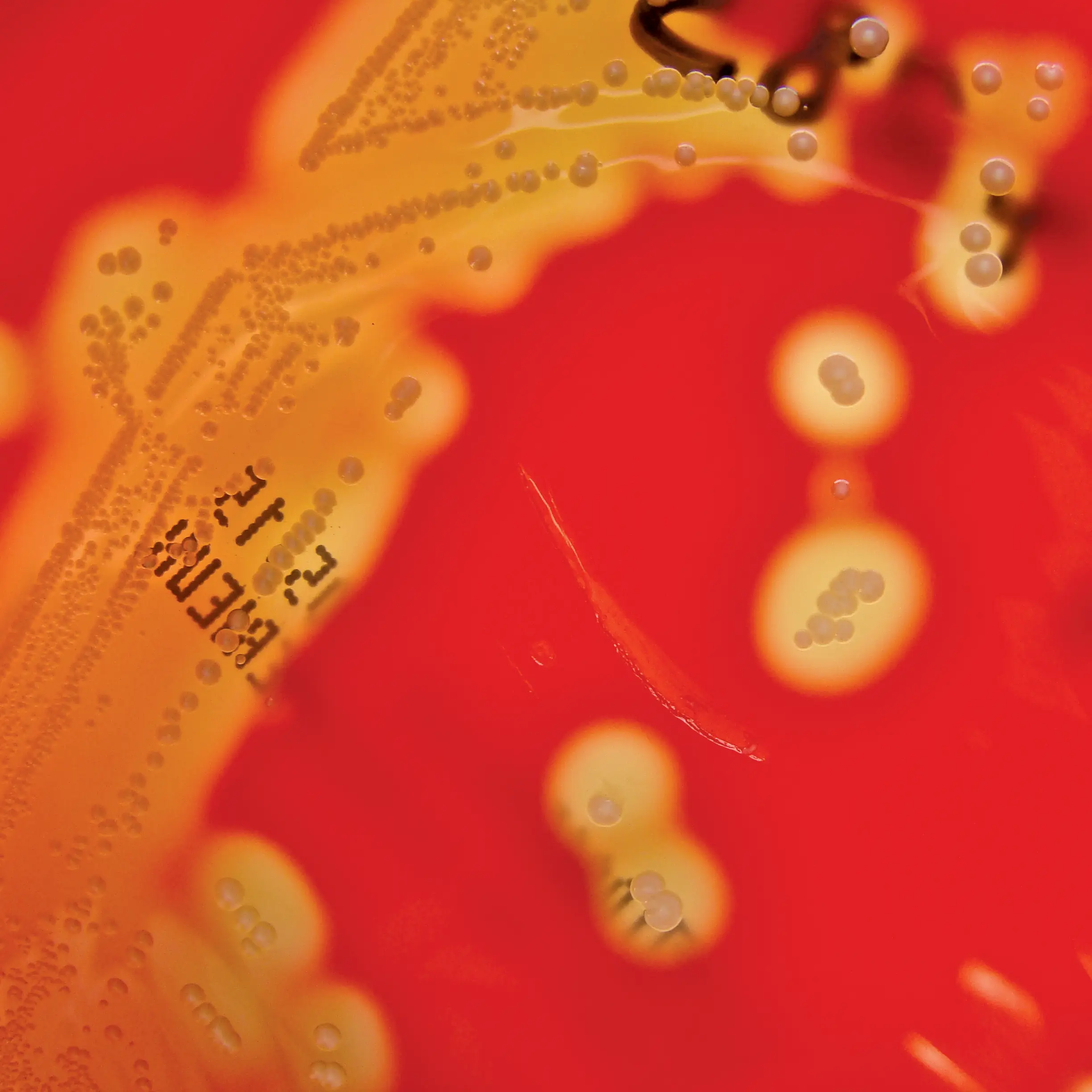 Many early studies on microRNAs and RNAi were done in worms like the Caenorhabditis elegans pictured here. 